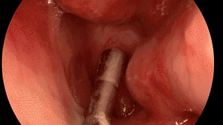 微信(xin)圖片_20200521111921.gif 微信(xin)圖片_20200521111921.gif