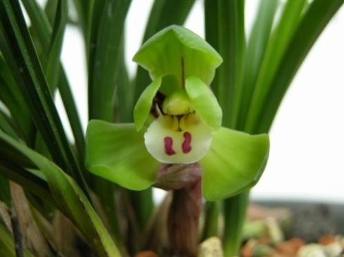 靜脈血栓栓塞症